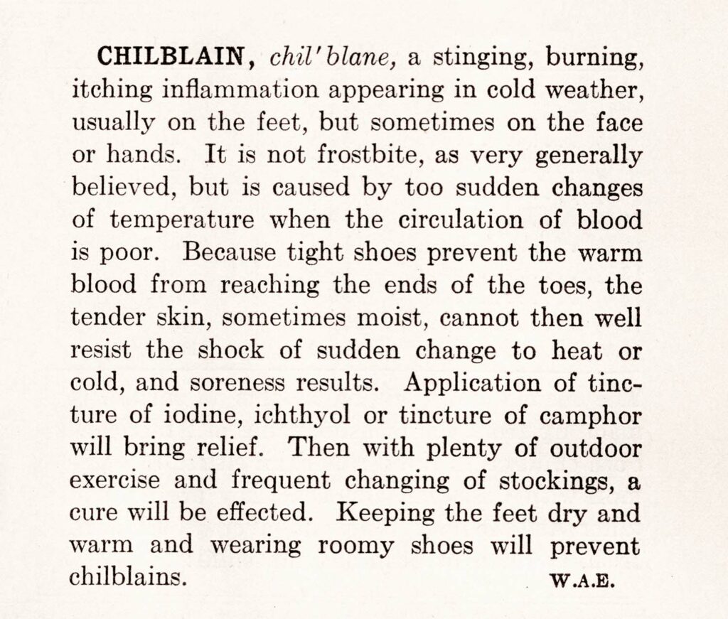 Chillblain Web